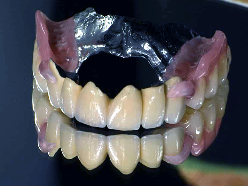 Οδοντοτεχνικό Εργαστήριο | Τσικρικάς